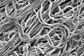 This is a scanning electron microscope image of the new ultra-fine fibers created by the MIT team. Image courtesy of the researchers.